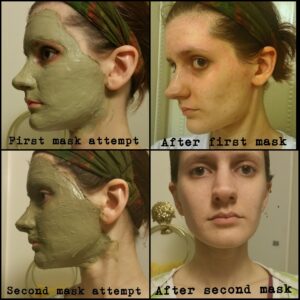 AztecClay-mask-acne-1