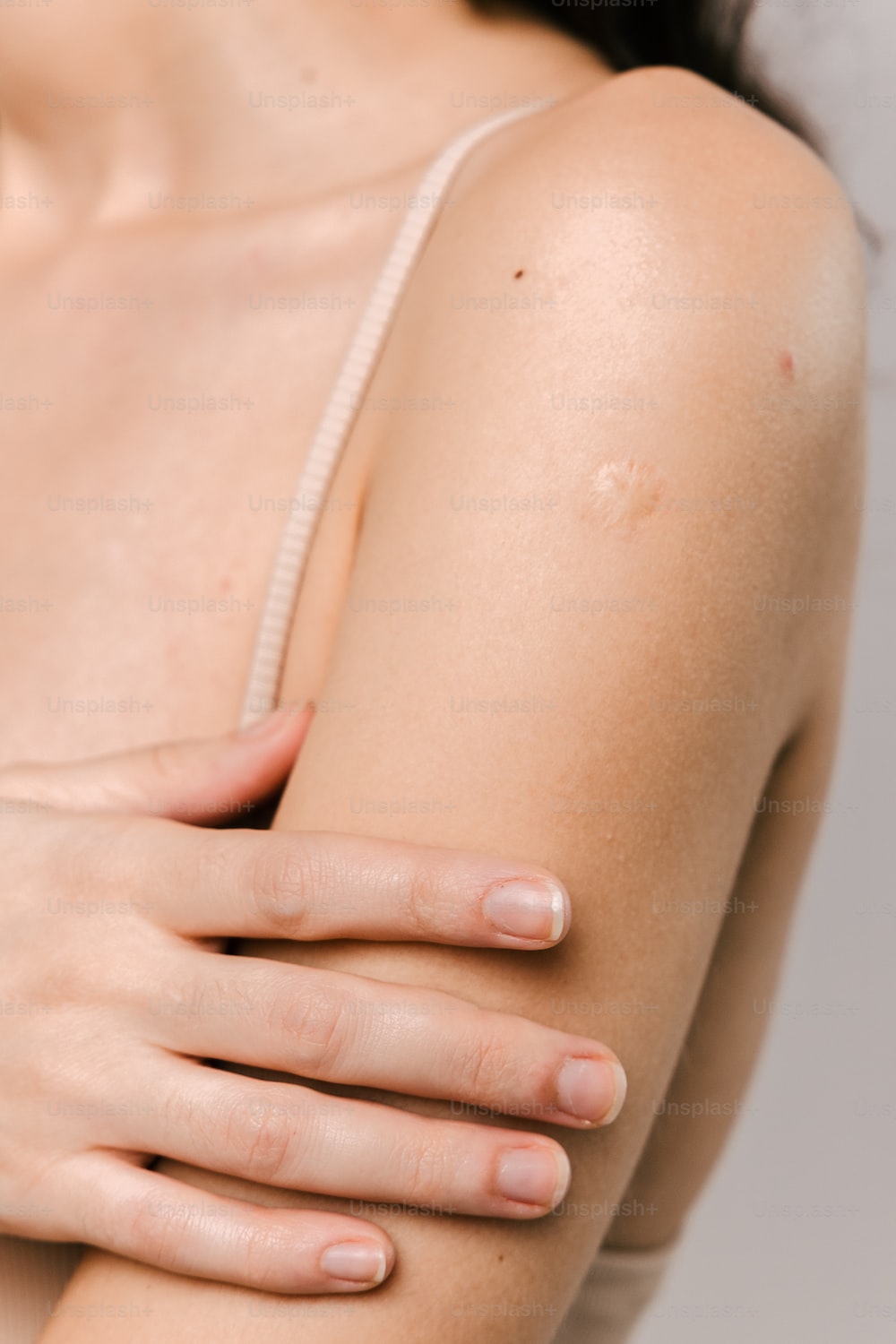 Cómo maquillar cicatrices quirúrgicas